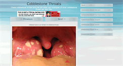 Desktop Screenshot of cobblestonethroat.com