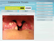 Tablet Screenshot of cobblestonethroat.com